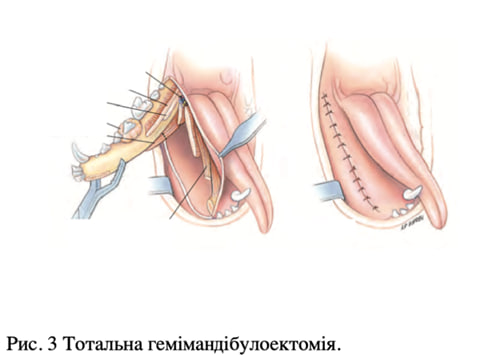 Хирургическое лечение новообразований ротовой полости у собак и кошек